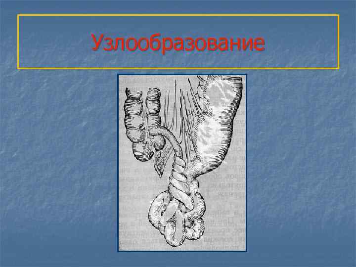 Узлообразование 