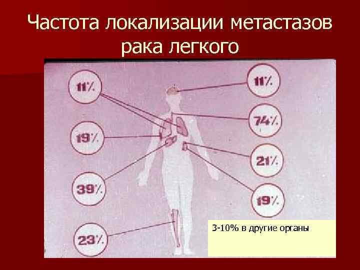 Частота локализации метастазов рака легкого 3 -10% в другие органы 