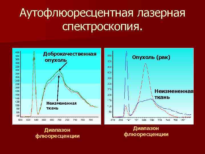 Аутофлюоресцентная лазерная спектроскопия. Доброкачественная опухоль Опухоль (рак) Неизмененная ткань Диапазон флюоресценции 