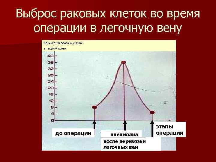 Выброс раковых клеток во время операции в легочную вену Количество раковых клеток в тыс/мм
