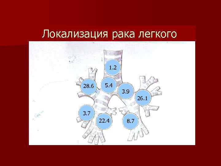 Локализация рака легкого 1. 2 28. 6 5. 4 3. 9 3. 7 22.