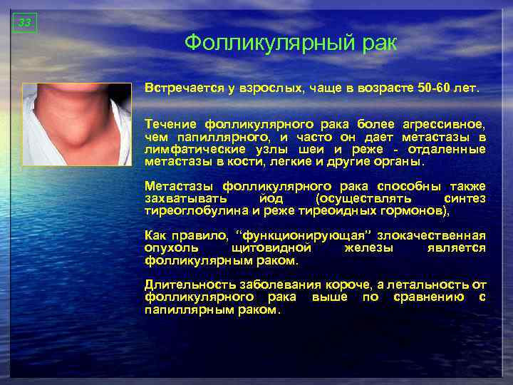 33 Фолликулярный рак Встречается у взрослых, чаще в возрасте 50 -60 лет. Течение фолликулярного