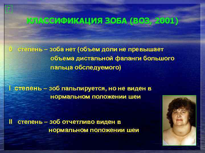7 КЛАССИФИКАЦИЯ ЗОБА (ВОЗ, 2001) 0 степень – зоба нет (объем доли не превышает