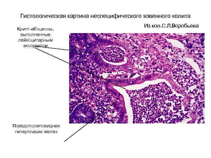 Цитологическая картина неспецифического воспаления что это