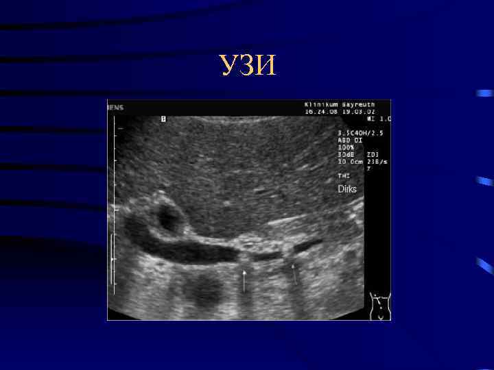 УЗИ 