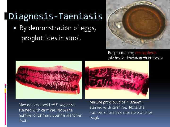 Diagnosis-Taeniasis By demonstration of eggs, proglottides in stool. Egg containing oncosphere(six hooked hexacanth embryo)