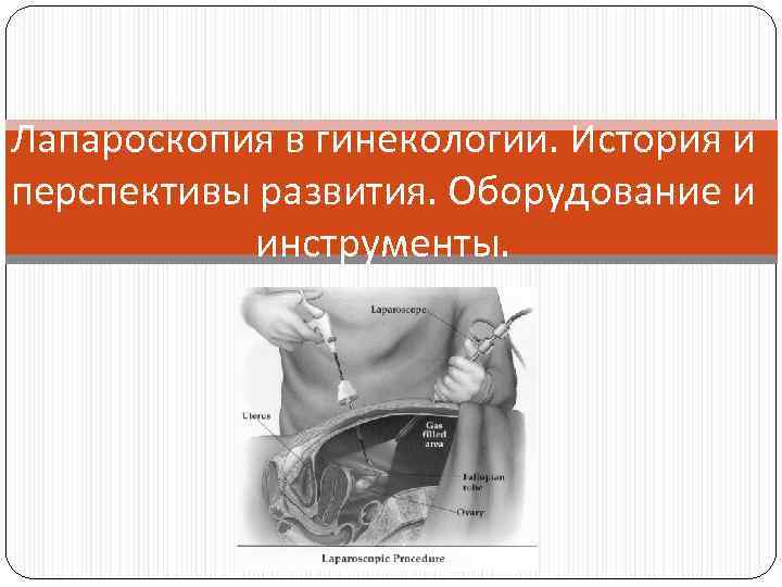 Лапароскопия в гинекологии. История и перспективы развития. Оборудование и инструменты. 