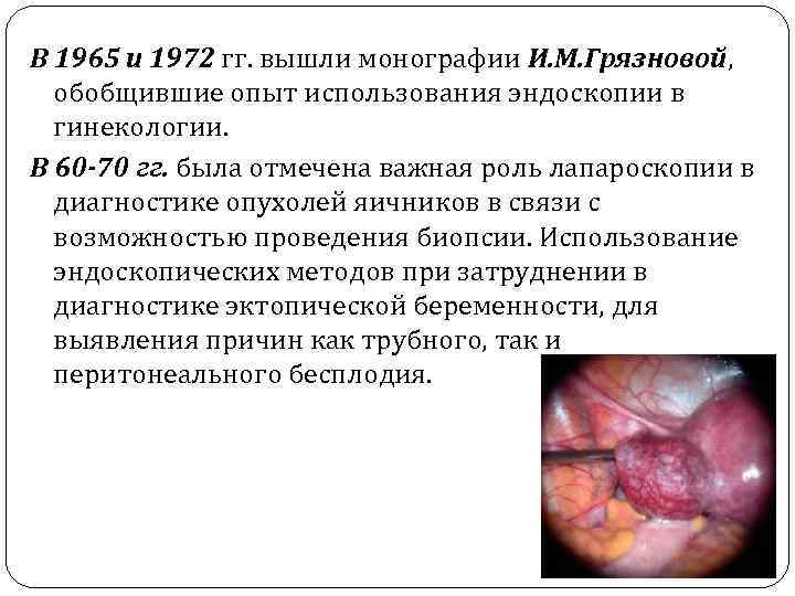 В 1965 и 1972 гг. вышли монографии И. М. Грязновой, обобщившие опыт использования эндоскопии