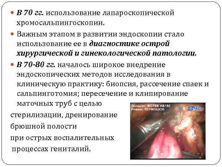  В 70 гг. использование лапароскопической хромосальпингоскопии. Важным этапом в развитии эндоскопии стало использование