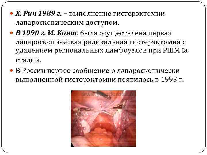  Х. Рич 1989 г. – выполнение гистерэктомии лапароскопическим доступом. В 1990 г. М.