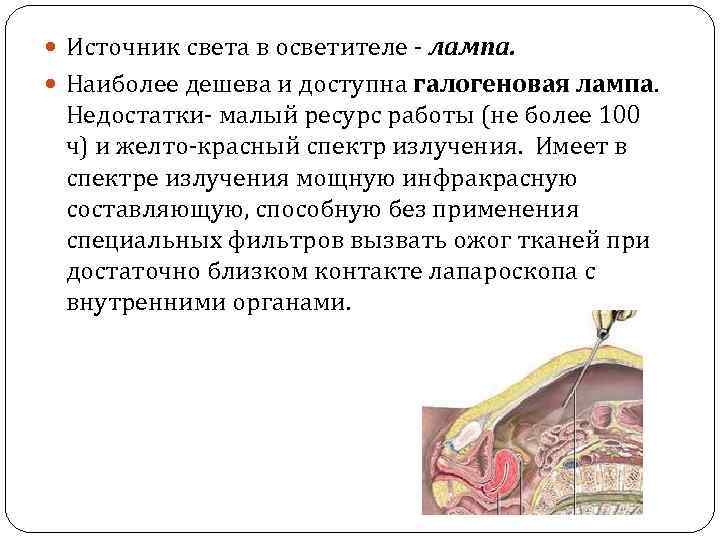  Источник света в осветителе - лампа. Наиболее дешева и доступна галогеновая лампа. Недостатки-