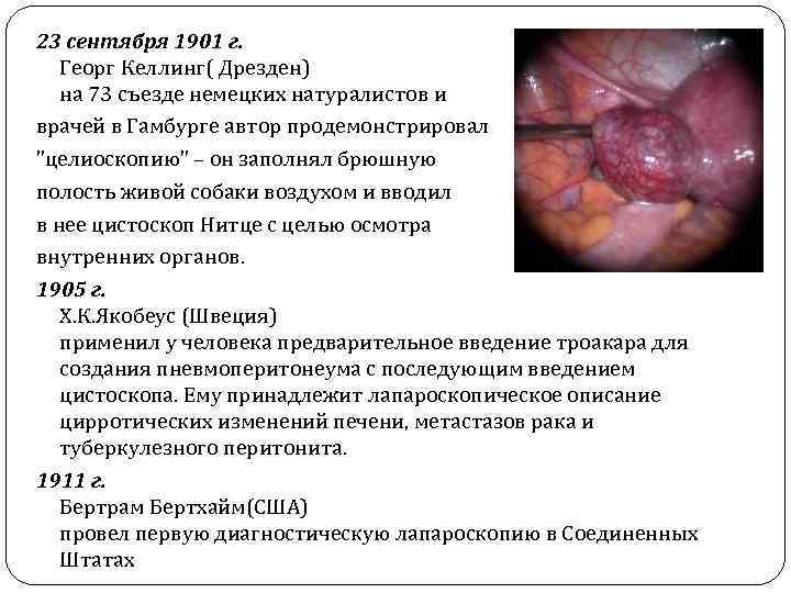 23 сентября 1901 г. Георг Келлинг( Дрезден) на 73 съезде немецких натуралистов и врачей