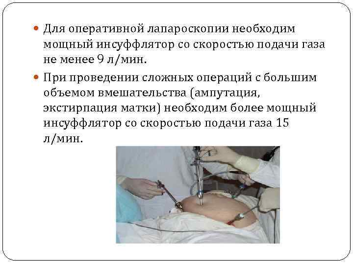  Для оперативной лапароскопии необходим мощный инсуффлятор со скоростью подачи газа не менее 9