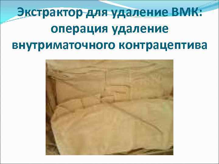 Экстрактор для удаление ВМК: операция удаление внутриматочного контрацептива 