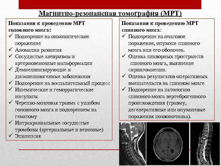 Магнитно-резонансная томография (МРТ) Показания к проведению МРТ головного мозга: ü Подозрение на онкологическое поражение