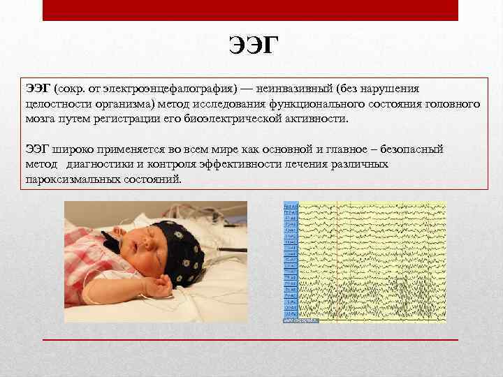 ЭЭГ (сокр. от электроэнцефалография) — неинвазивный (без нарушения целостности организма) метод исследования функционального состояния