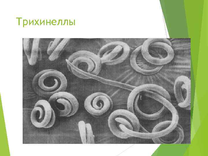 Трихинеллы 