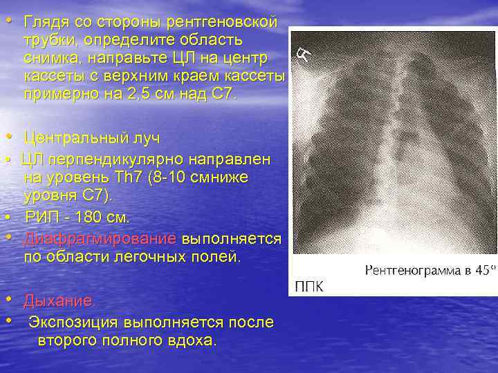  • Глядя со стороны рентгеновской трубки, определите область снимка, направьте ЦЛ на центр