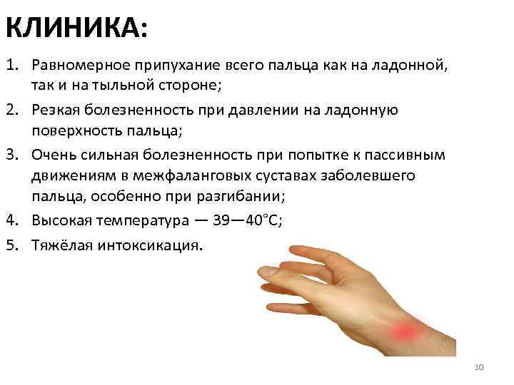 КЛИНИКА: 1. Равномерное припухание всего пальца как на ладонной, так и на тыльной стороне;
