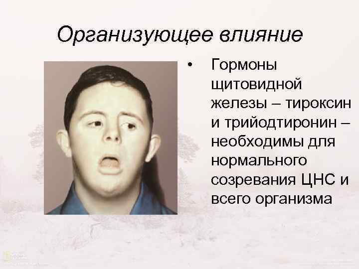 Организующее влияние • Гормоны щитовидной железы – тироксин и трийодтиронин – необходимы для нормального