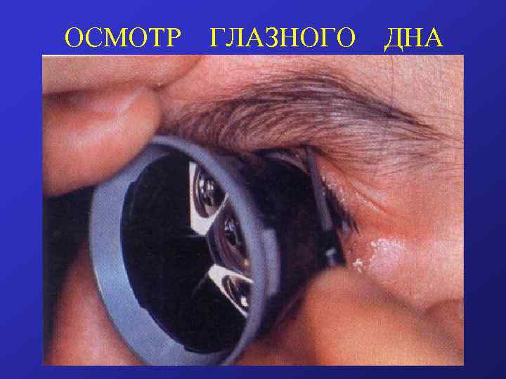 ОСМОТР ГЛАЗНОГО ДНА 
