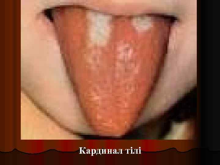 Кардинал тілі 