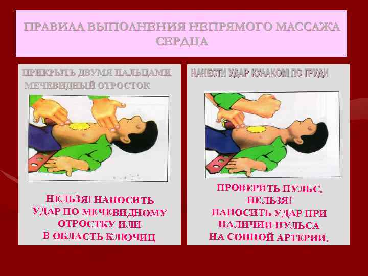 ПРАВИЛА ВЫПОЛНЕНИЯ НЕПРЯМОГО МАССАЖА СЕРДЦА ПРИКРЫТЬ ДВУМЯ ПАЛЬЦАМИ МЕЧЕВИДНЫЙ ОТРОСТОК НЕЛЬЗЯ! НАНОСИТЬ УДАР ПО