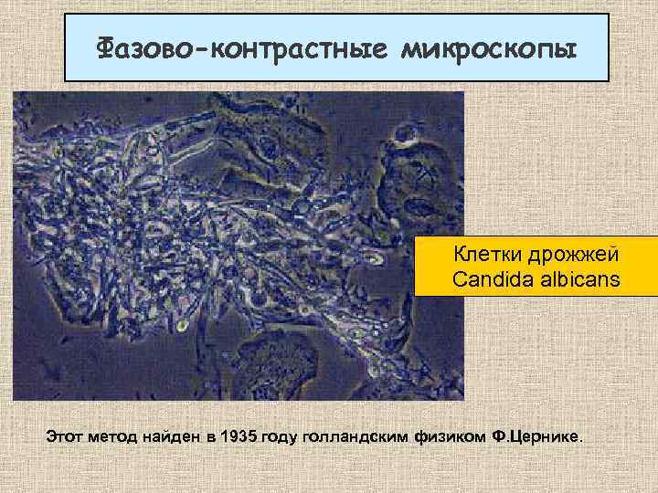 Фазово-контрастные микроскопы Клетки дрожжей Candida albicans Этот метод найден в 1935 году голландским физиком