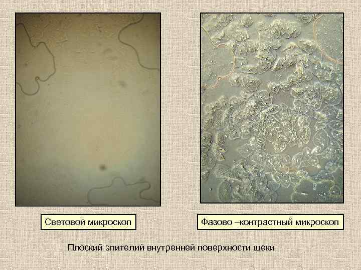 Световой микроскоп Фазово –контрастный микроскоп Плоский эпителий внутренней поверхности щеки 