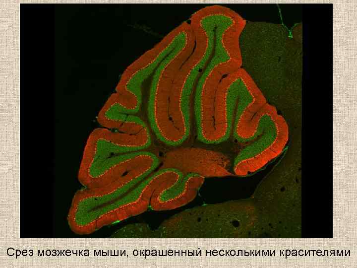 Срез мозжечка мыши, окрашенный несколькими красителями 