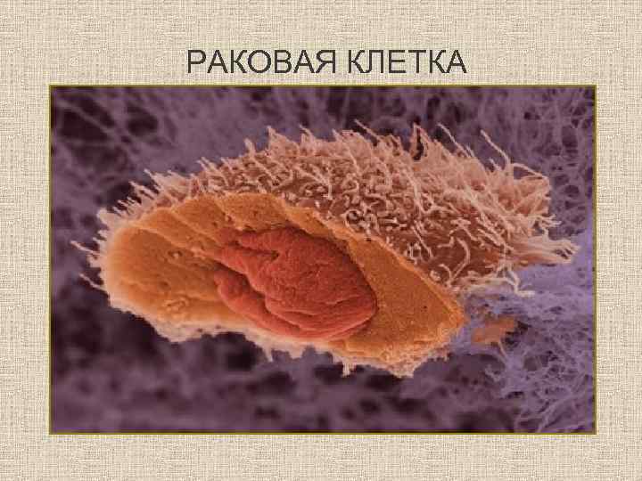 РАКОВАЯ КЛЕТКА 