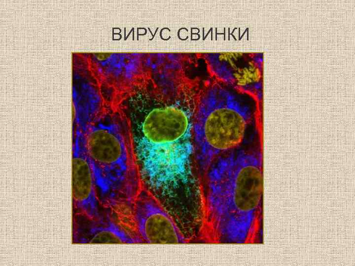 ВИРУС СВИНКИ 