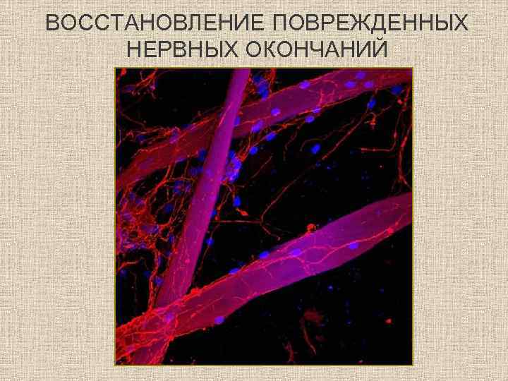 ВОССТАНОВЛЕНИЕ ПОВРЕЖДЕННЫХ НЕРВНЫХ ОКОНЧАНИЙ 