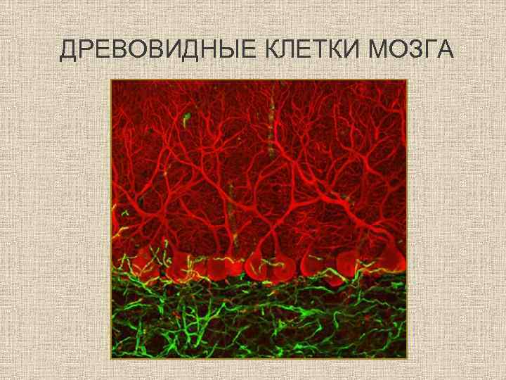 ДРЕВОВИДНЫЕ КЛЕТКИ МОЗГА 