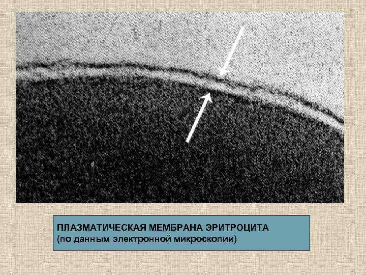 ПЛАЗМАТИЧЕСКАЯ МЕМБРАНА ЭРИТРОЦИТА (по данным электронной микроскопии) 