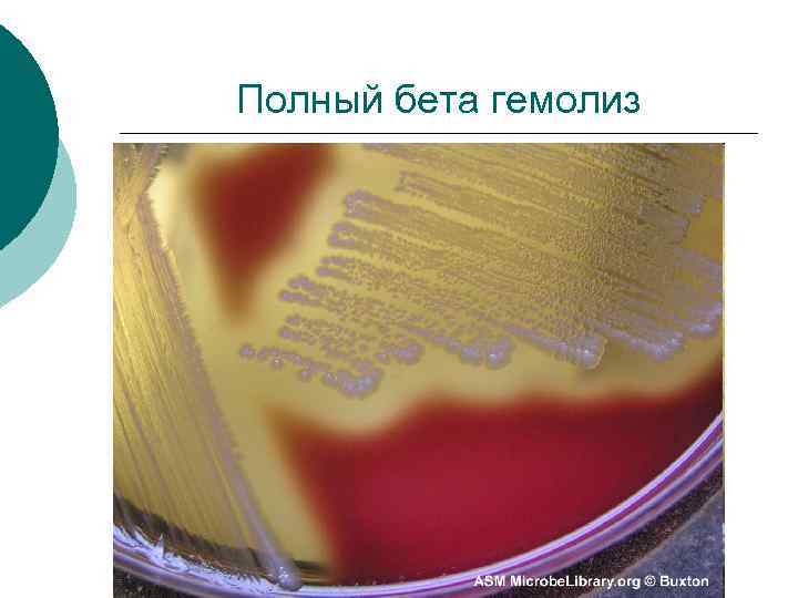 Полный бета гемолиз 