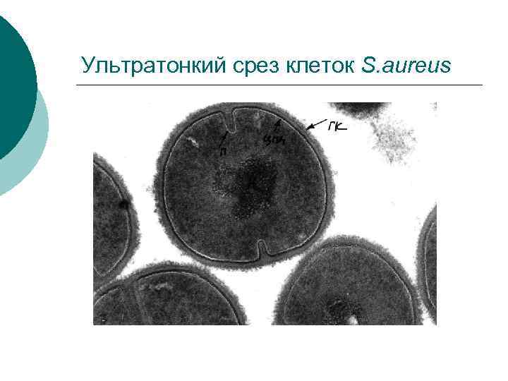Ультратонкий срез клеток S. aureus 