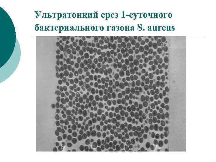 Ультратонкий срез 1 -суточного бактериального газона S. aureus 