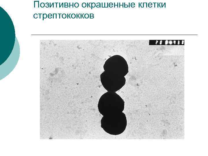 Позитивно окрашенные клетки стрептококков 