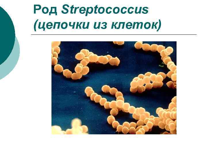 Род Streptococcus (цепочки из клеток) 