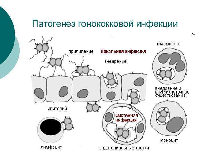 Патогенез гонококковой инфекции 