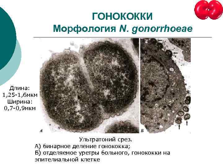 ГОНОКОККИ Морфология N. gonorrhoeae Длина: 1, 25 -1, 6 мкм Ширина: 0, 7 -0,