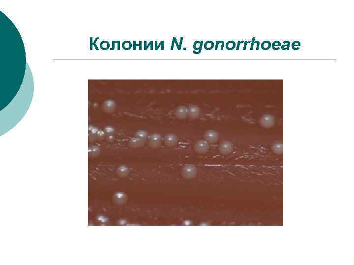 Колонии N. gonorrhoeae 