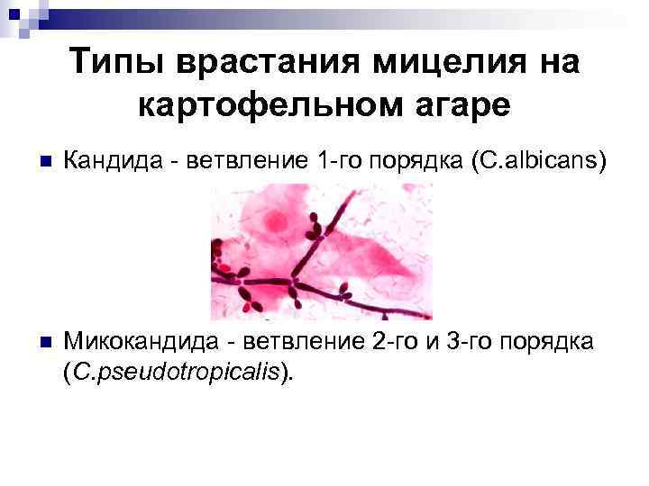 Типы врастания мицелия на картофельном агаре n Кандида - ветвление 1 -го порядка (C.