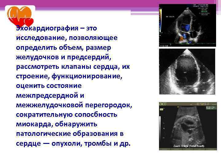 Эхокардиография – это исследование, позволяющее определить объем, размер желудочков и предсердий, рассмотреть клапаны сердца,