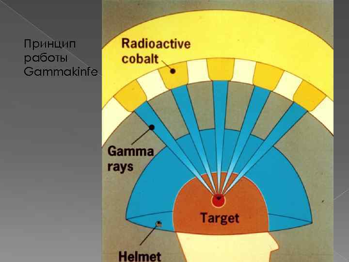 Принцип работы Gammakinfe 