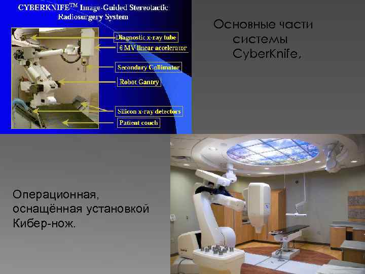 Основные части системы Cyber. Knife, Операционная, оснащённая установкой Кибер-нож. 