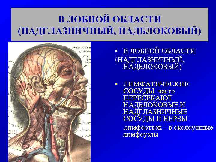 В ЛОБНОЙ ОБЛАСТИ (НАДГЛАЗНИЧНЫЙ, НАДБЛОКОВЫЙ) • ЛИМФАТИЧЕСКИЕ СОСУДЫ часто ПЕРЕСЕКАЮТ НАДБЛОКОВЫЕ И НАДГЛАЗНИЧНЫЕ СОСУДЫ