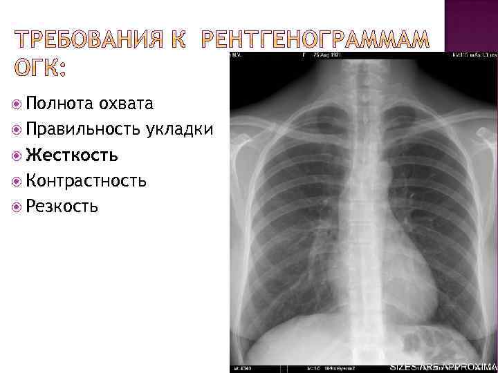  Полнота охвата Правильность укладки Жесткость Контрастность Резкость 