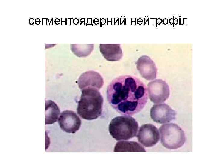 сегментоядерний нейтрофіл 